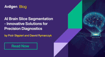 Blog Article: AI Brain Slice Segmentation - Innovative Solutions for Precision Diagnostics