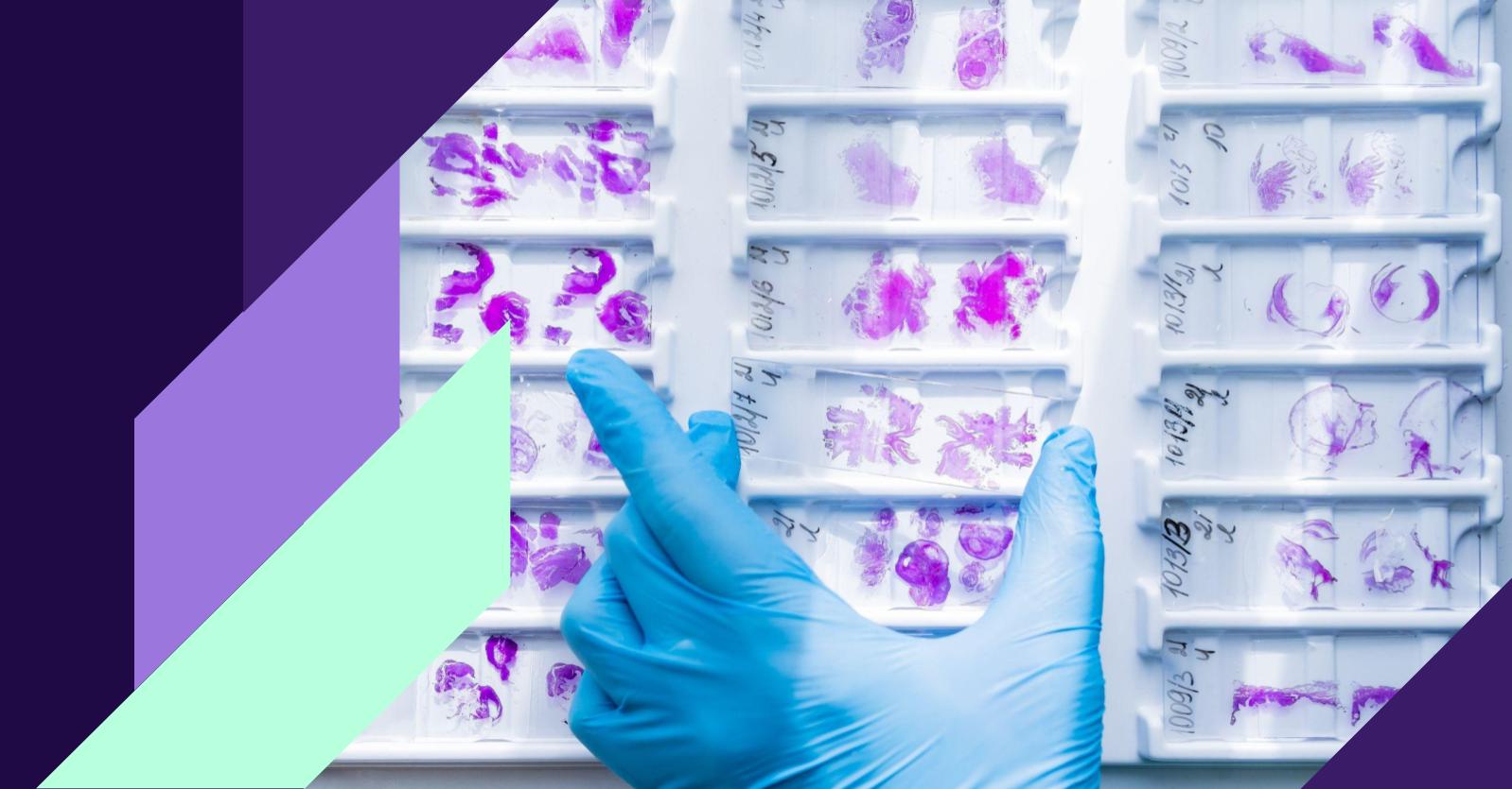 Data visualization representing AI-driven drug discovery using UK Biobank data